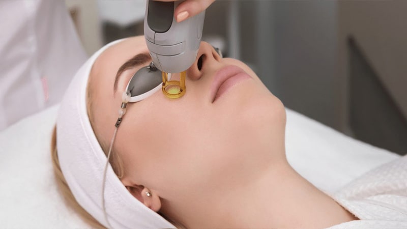 درمان با لیزر (Laser treatment)